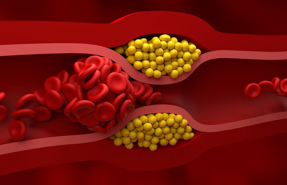 Omega-3 and Triglycerides: Lowering the Risk of Heart Disease Naturally